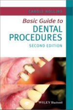 Basic Guide to Dental Procedures, 2nd Edition