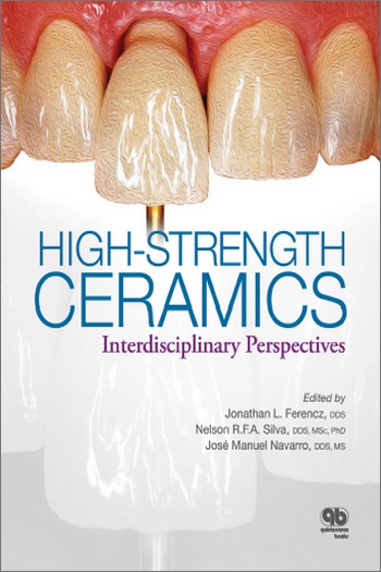 High-Strength Ceramics: Interdisciplinary Perspectives High-Strength Ceramics: Interdisciplinary Perspectives