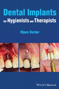 Dental Implants for Hygienists and Therapists Dental Implants for Hygienists and Therapists