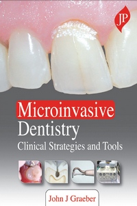 Microinvasive Dentistry: Clinical Strategies and Tools Microinvasive Dentistry: Clinical Strategies and Tools