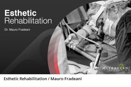 Esthetic Rehabilitation: Esthetic And Functional Integration Of The ...