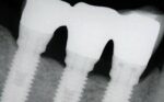 Online Residency Program: A-Z in Implant Dentistry