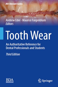 Tooth Wear: An Authoritative Reference for Dental Professionals and Students, 3rd Edition (BDJ Clinician’s Guides) Tooth Wear: An Authoritative Reference for Dental Professionals and Students, 3rd Edition (BDJ Clinician’s Guides)