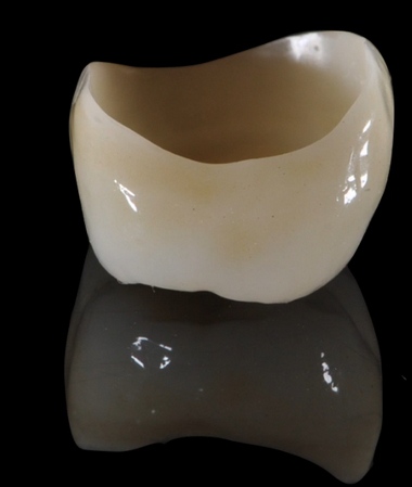 Vertical preparation protocols: The complete guide in 24 lessons from Tomorrow Tooth