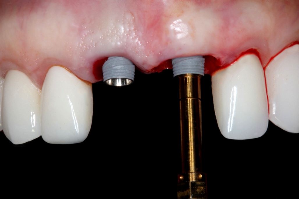 Online Residency Program: A-Z in Implant Dentistry Online Residency Program: A-Z in Implant Dentistry