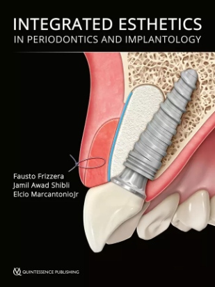 Integrated Esthetics in Periodontics and Implantology Integrated Esthetics in Periodontics and Implantology