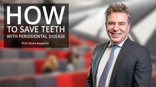 How To Save Teeth With Periodontal Disease How To Save Teeth With Periodontal Disease