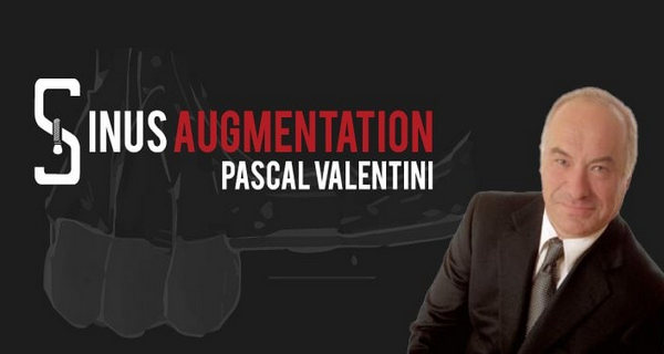 Sinus Augmentation International Sinus Augmentation International