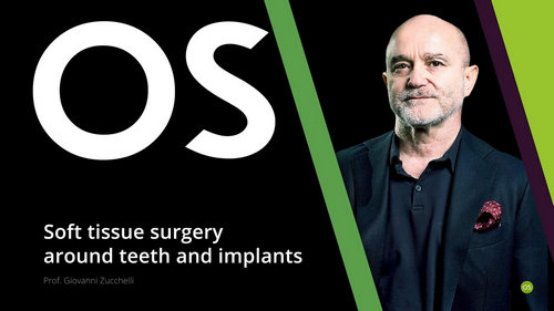 Soft Tissue Surgery Around Teeth and Implants Soft Tissue Surgery Around Teeth and Implants