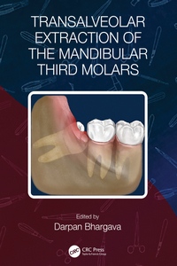 Transalveolar Extraction of the Mandibular Third Molars Transalveolar Extraction of the Mandibular Third Molars