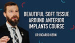 Beautiful Soft Tissue Around Anterior Implants