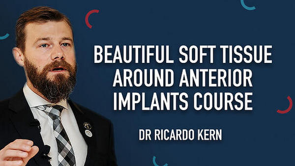 Beautiful Soft Tissue Around Anterior Implants Beautiful Soft Tissue Around Anterior Implants