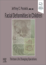 Facial Deformities in Children: Thirteen Life Changing Operations