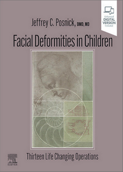 Facial Deformities in Children: Thirteen Life Changing Operations Facial Deformities in Children: Thirteen Life Changing Operations