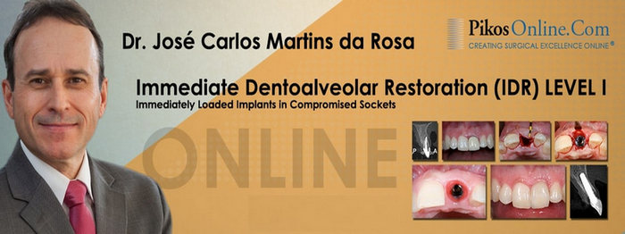 Immediate Dentoalveolar Restoration (IDR) Level 1 Immediate Dentoalveolar Restoration (IDR) Level 1