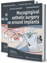 Mucogingival Esthetic Surgery Around Implants ( 2 Volumes)