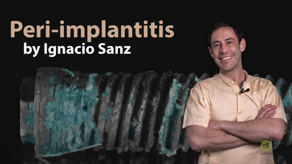 Peri-Implantitis: Prevention and Treatment (Video Course) Peri-Implantitis: Prevention and Treatment (Video Course)