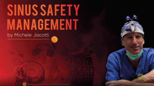 Sinus Safety Management (Sinus Floor Augmentation) Sinus Safety Management (Sinus Floor Augmentation)
