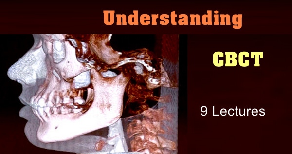 Understanding CBCT (9 Lectures) Understanding CBCT (9 Lectures)