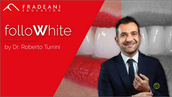 Follow White International – Tooth Whitening Follow White International – Tooth Whitening