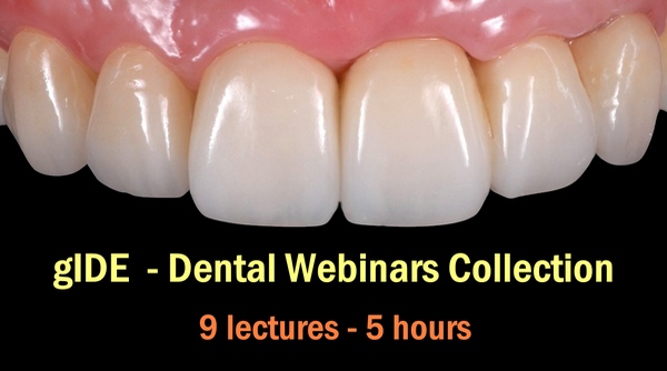 gIDE Dental Webinars Collection gIDE Dental Webinars Collection