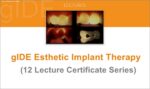 gIDE Esthetic Implant Therapy  (12 Lecture Series)