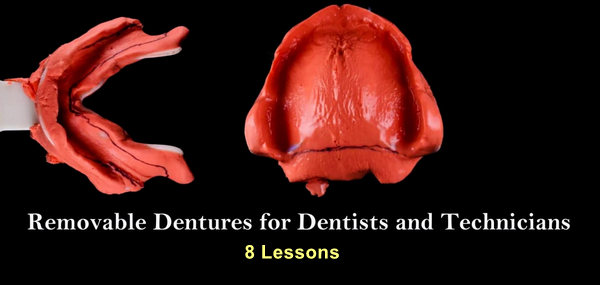 Removable Prosthodontics Archives Dentistry EBooks