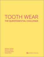 Tooth Wear The Quintessential Challenge (Epub & Converted PDF)