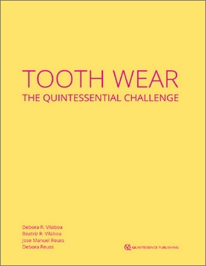 Tooth Wear The Quintessential Challenge (Epub & Converted PDF) Tooth Wear The Quintessential Challenge (Epub & Converted PDF)