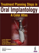Treatment Planning Steps in Oral Implantology: A Color Atlas