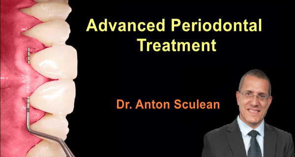Advanced Periodontal Treatment (Video Course) Advanced Periodontal Treatment (Video Course)