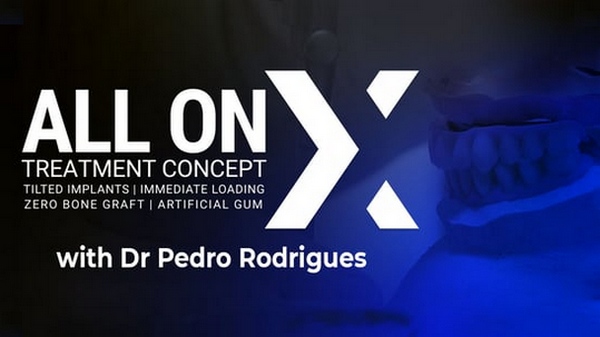 All On X Treatment Concept (Video Course) All On X Treatment Concept (Video Course)