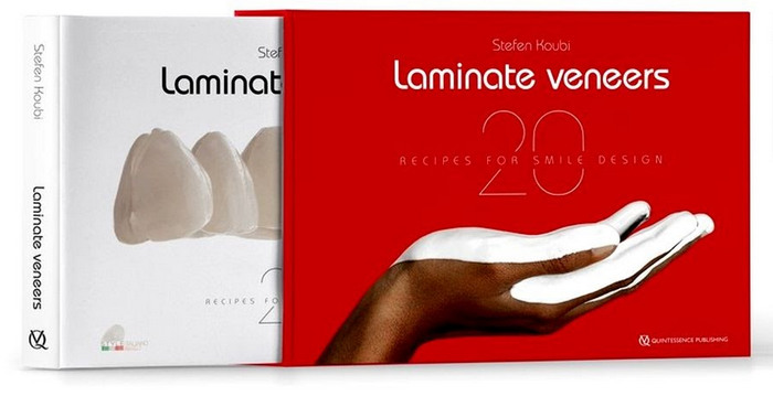 Laminate Veneers: 20 Recipes for Smile Design (Scanned Copy) Laminate Veneers: 20 Recipes for Smile Design (Scanned Copy)