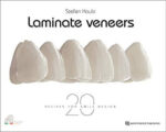Laminate Veneers- 20 Recipes for Smile Design