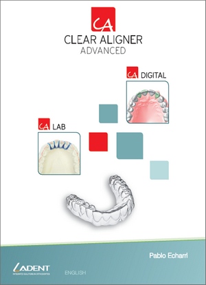 CA® Clear Aligner Book Advanced, volume 2 CA® Clear Aligner Book Advanced, volume 2