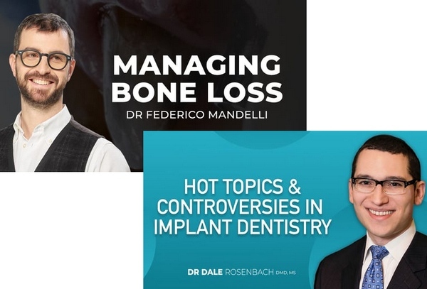 Controversies in Implant Dentistry and Managing Bone Loss Controversies in Implant Dentistry and Managing Bone Loss