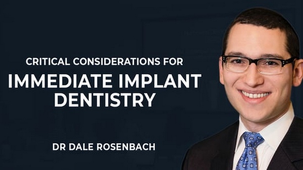 Critical Considerations for Immediate Implant Dentistry Critical Considerations for Immediate Implant Dentistry
