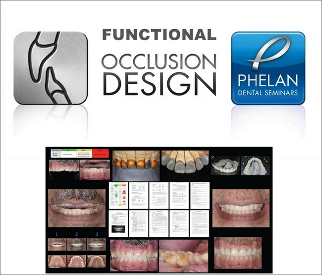 Functional Occlusion Design Dental Seminars (Full Bonus Package) Functional Occlusion Design Dental Seminars (Full Bonus Package)
