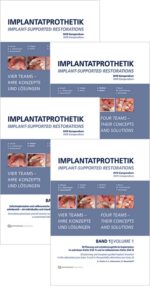 Implant-Supported Restorations – Vol. 1- 4 – (Video Course)