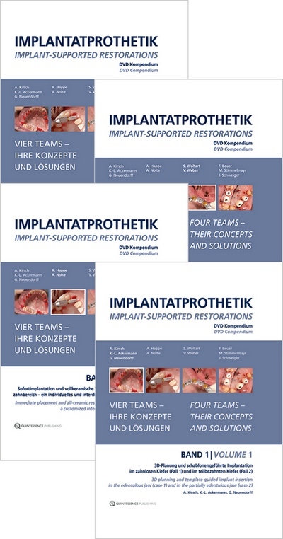 Implant-Supported Restorations – Vol. 1- 4 – (Video Course) Implant-Supported Restorations – Vol. 1- 4 – (Video Course)