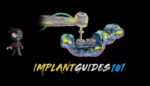The Implant Guides 101 Course