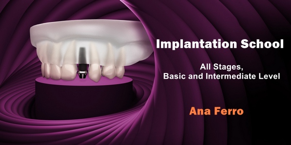 Implantation School: All Stages, Basic and Intermediate Level