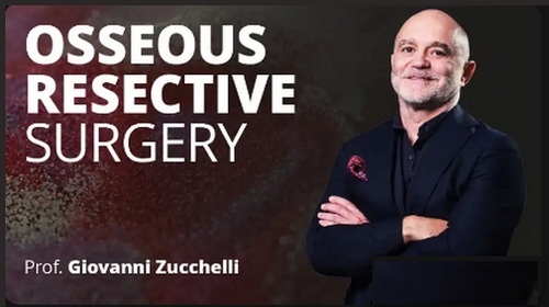 Osseous Resective Surgery Osseous Resective Surgery
