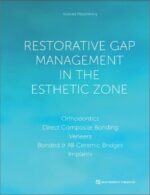 Restorative Gap Management in the Esthetic Zone
