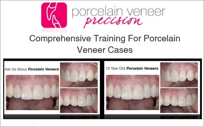 Porcelain Veneer Precision: Comprehensive Training for Porcelain Veneer Cases