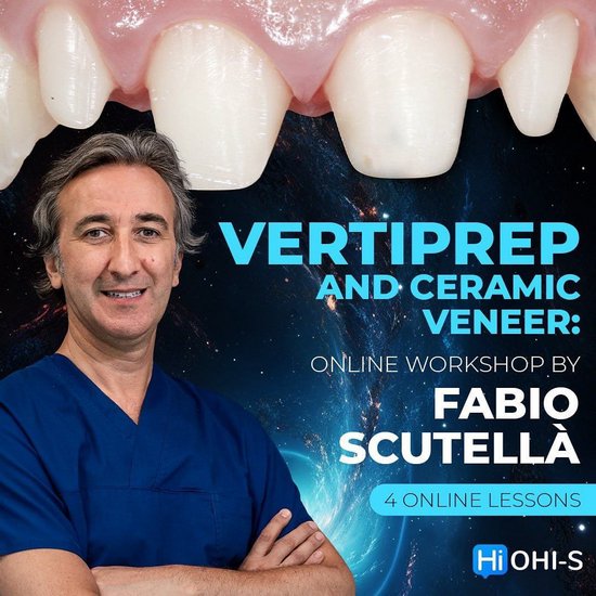 Vertical Preparation and Ceramic Veneers