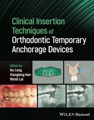 Clinical Insertion Techniques of Orthodontic Temporary Anchorage Devices