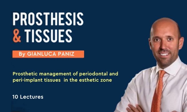 Prosthesis and Tissues (Prosthetic Management of Periodontal and Peri-Implant Tissues)