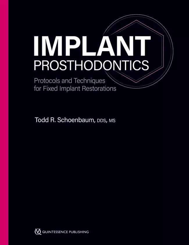 Implant Prosthodontics: Protocols and Techniques for Fixed Implant Restorations