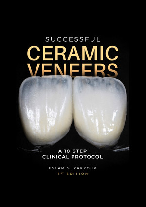 Successful Ceramic Veneers: 10 Steps Clinical Protocol